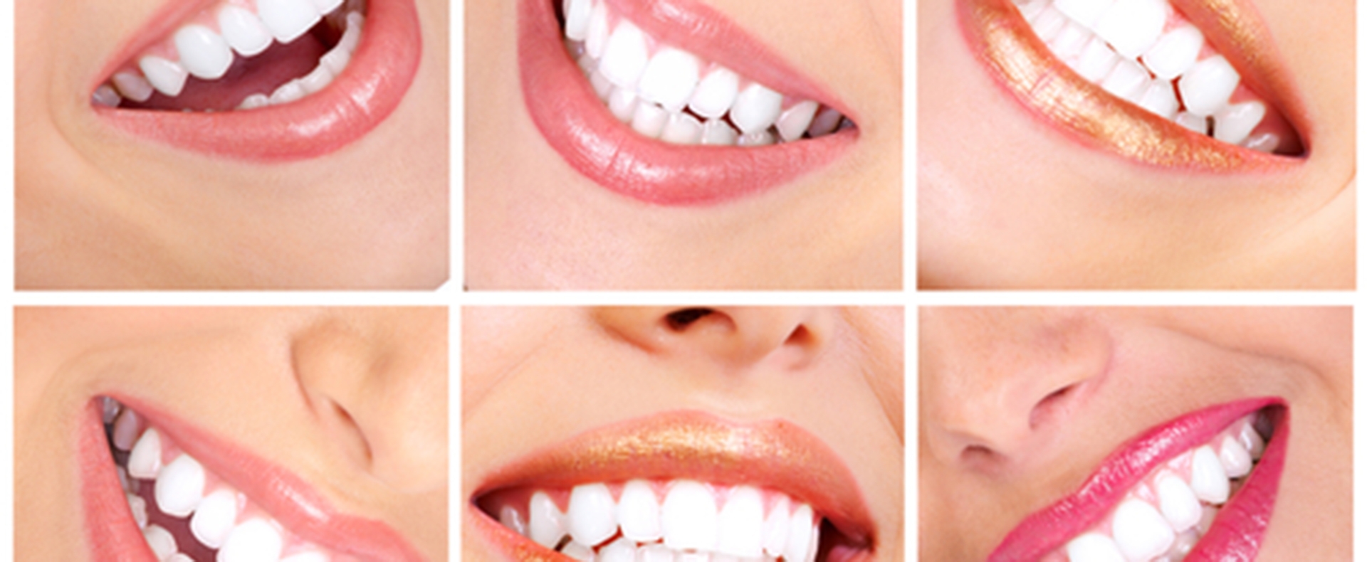 Seguro dental para autónomos